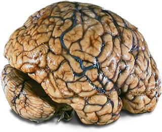 A brain